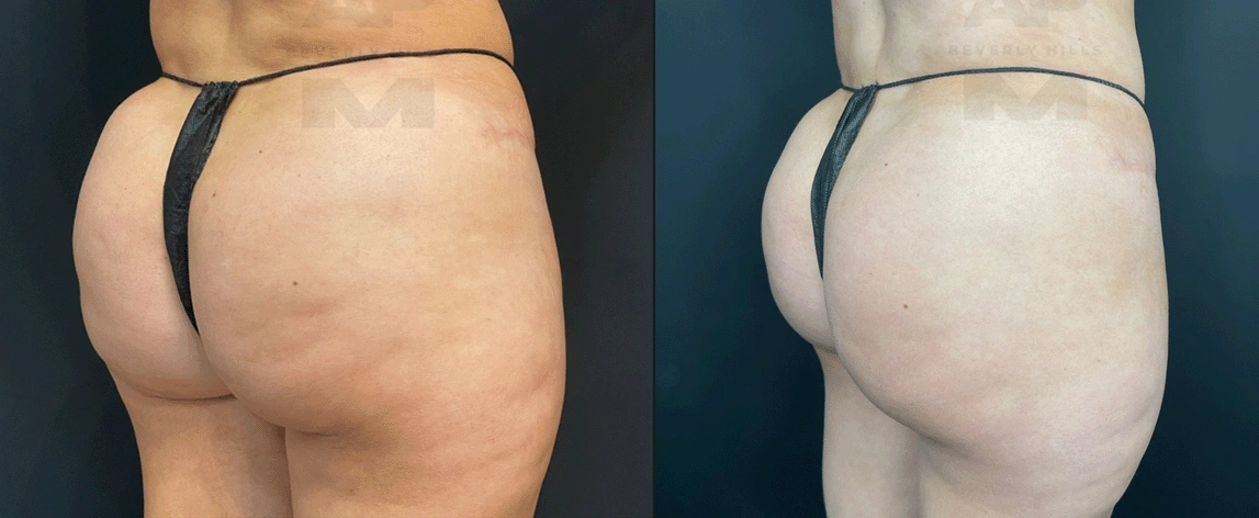 After Back Right Oblique_(1).jpg