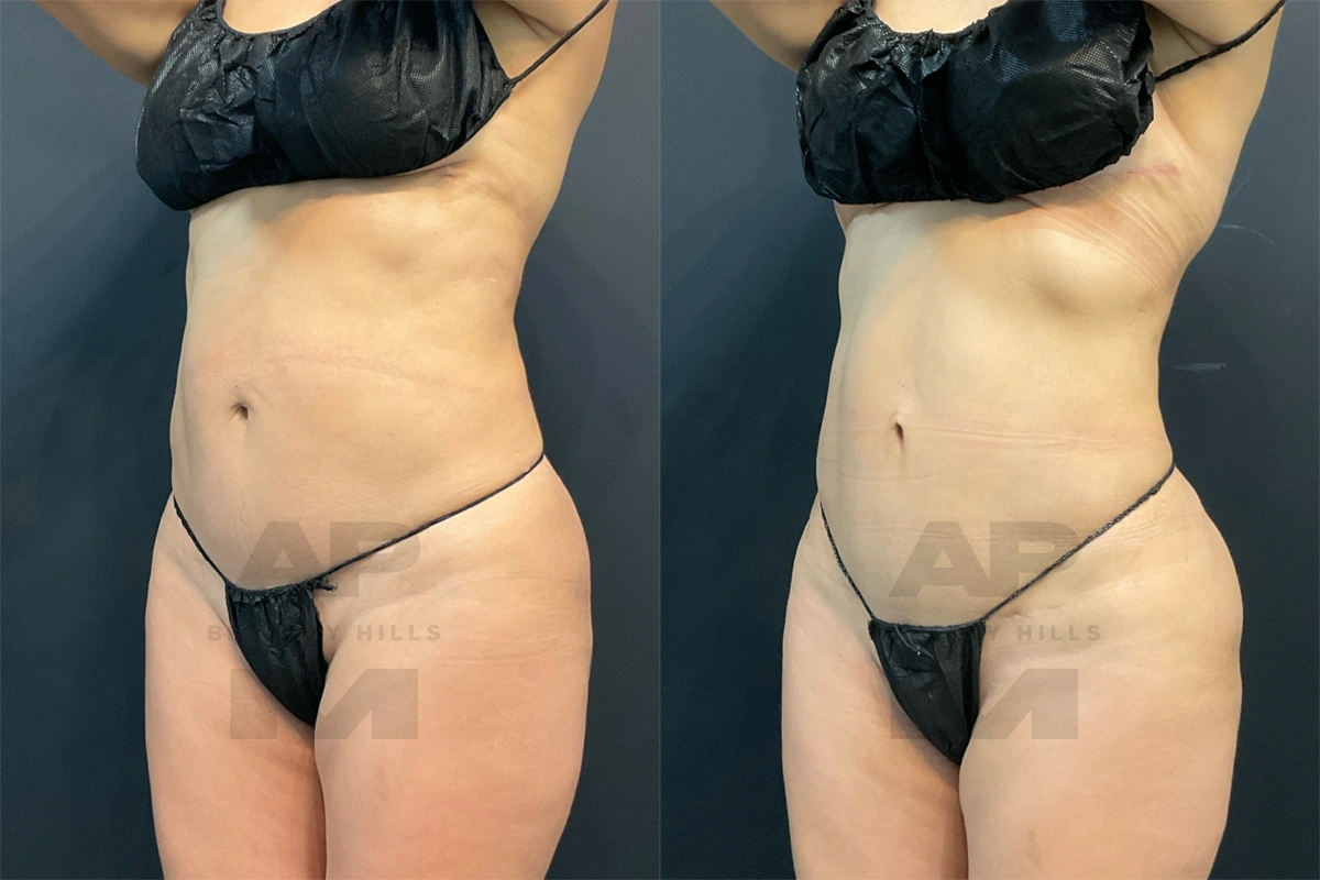 After Front Left Oblique_.jpg