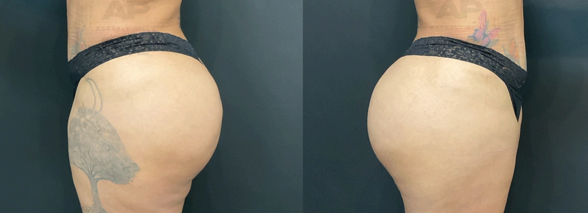 After Right Side.jpg