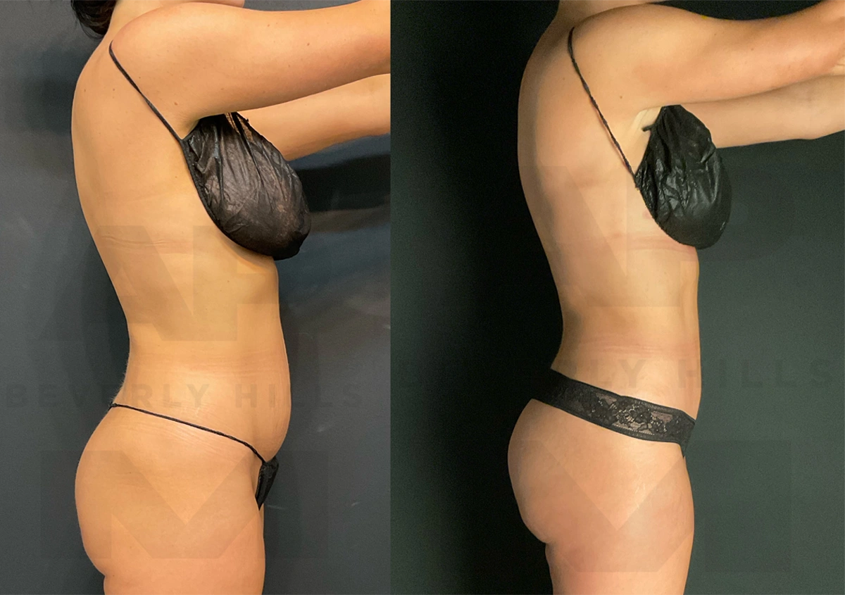 After Right Side_.jpg