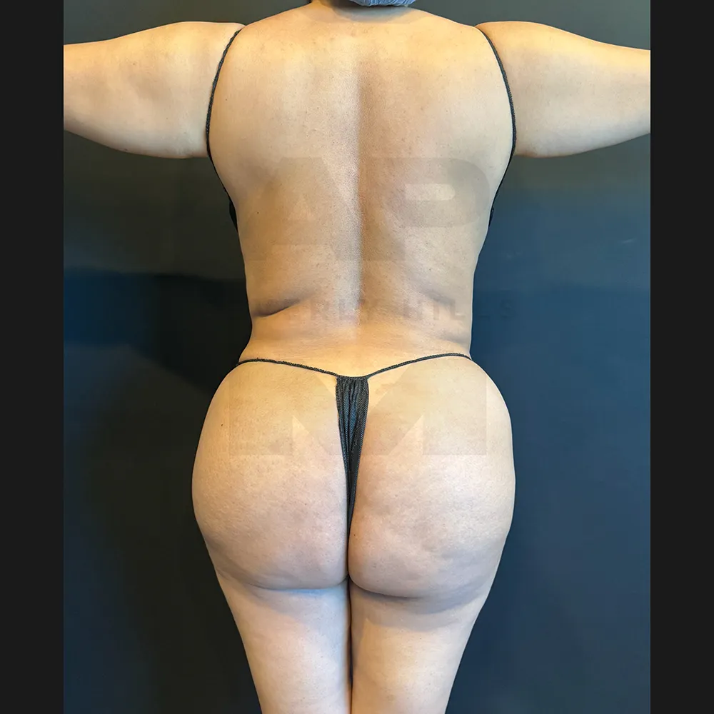aveli_ED_Back after