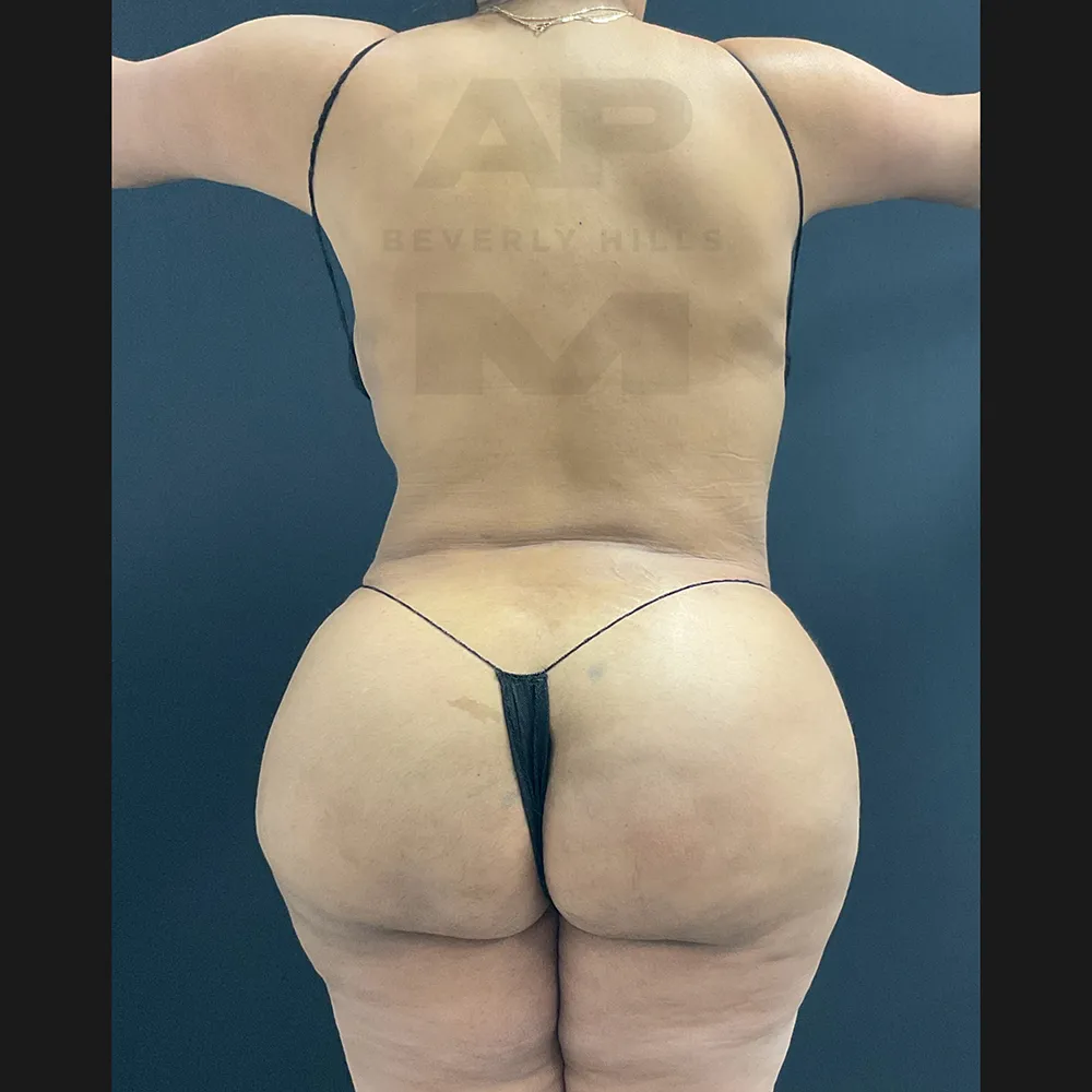 aveli_HM_Back after