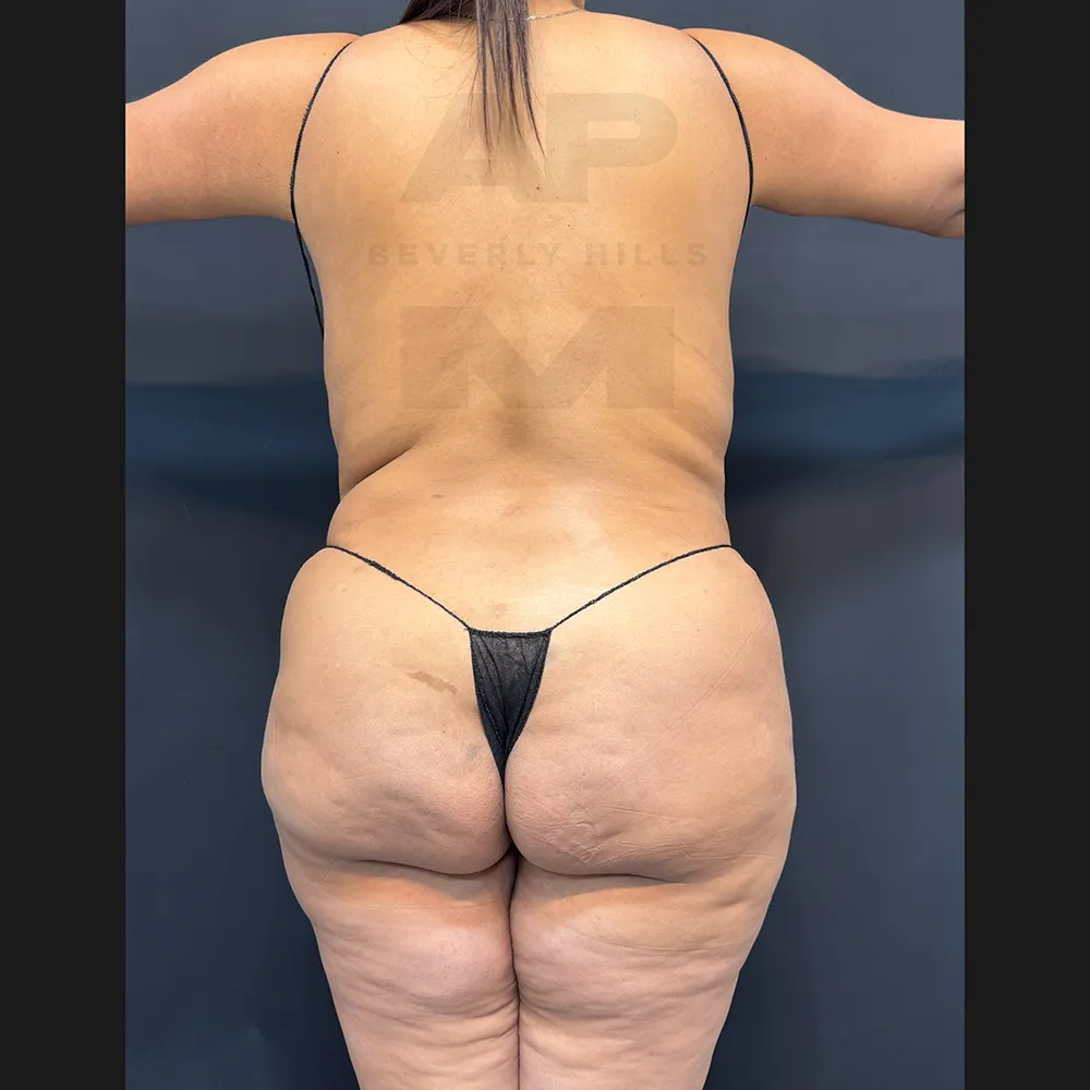 aveli_HM_back before
