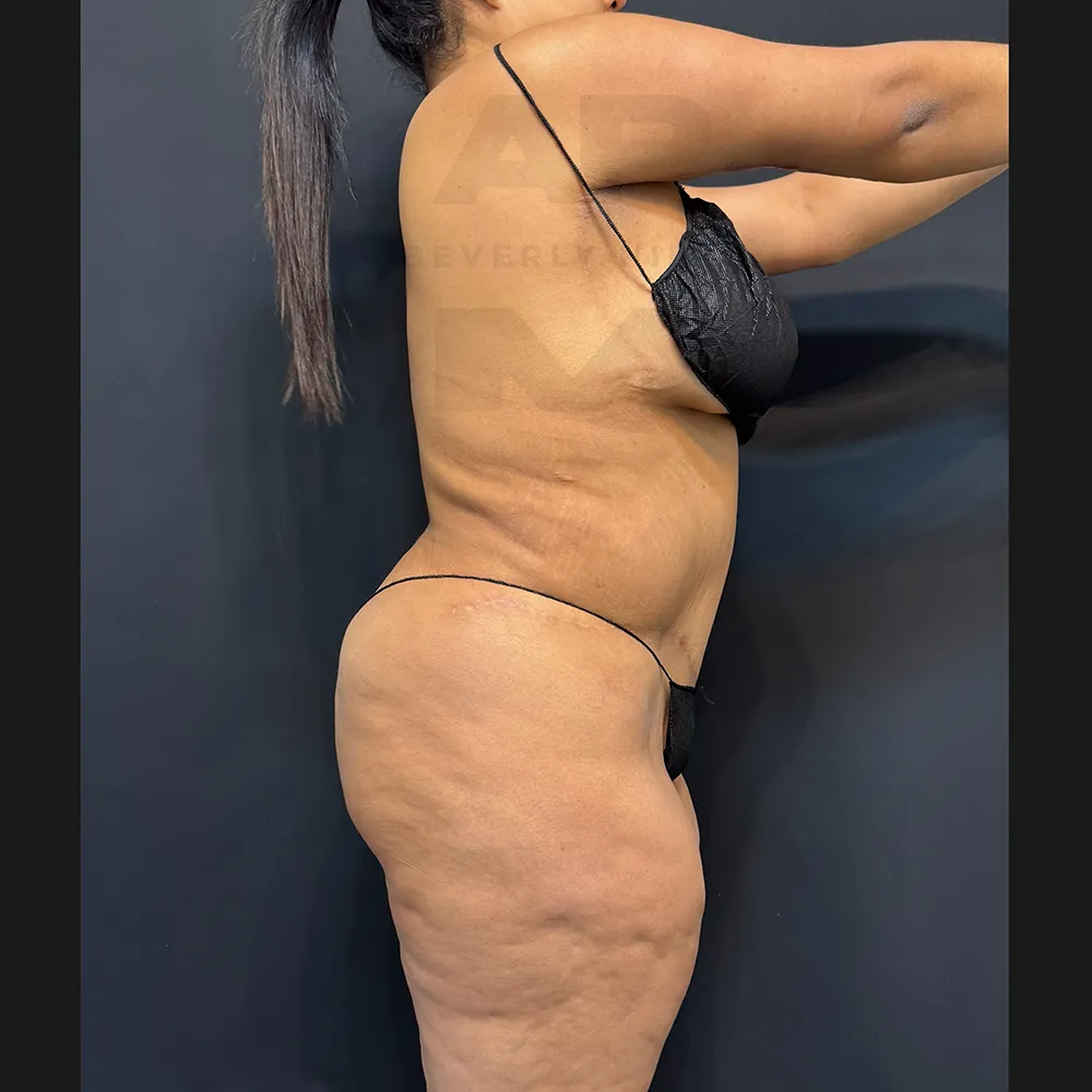 aveli_HM_right before