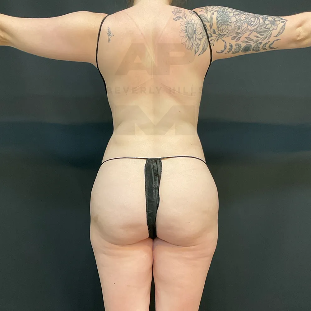 aveli_MP_back before_