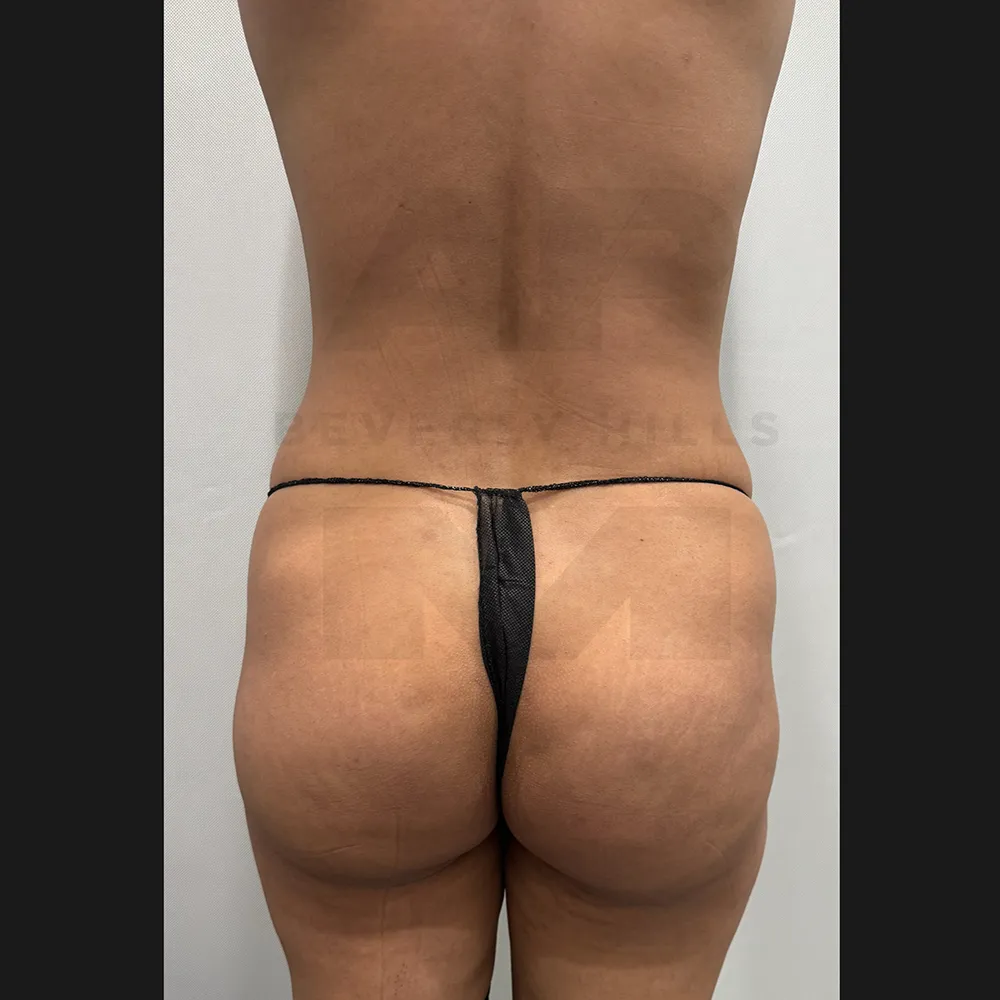 aveli_NS_Back after
