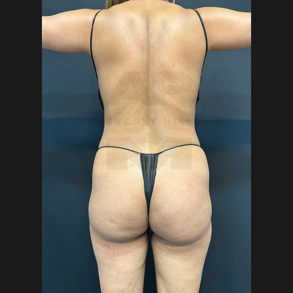 aveli_NS_Back before_